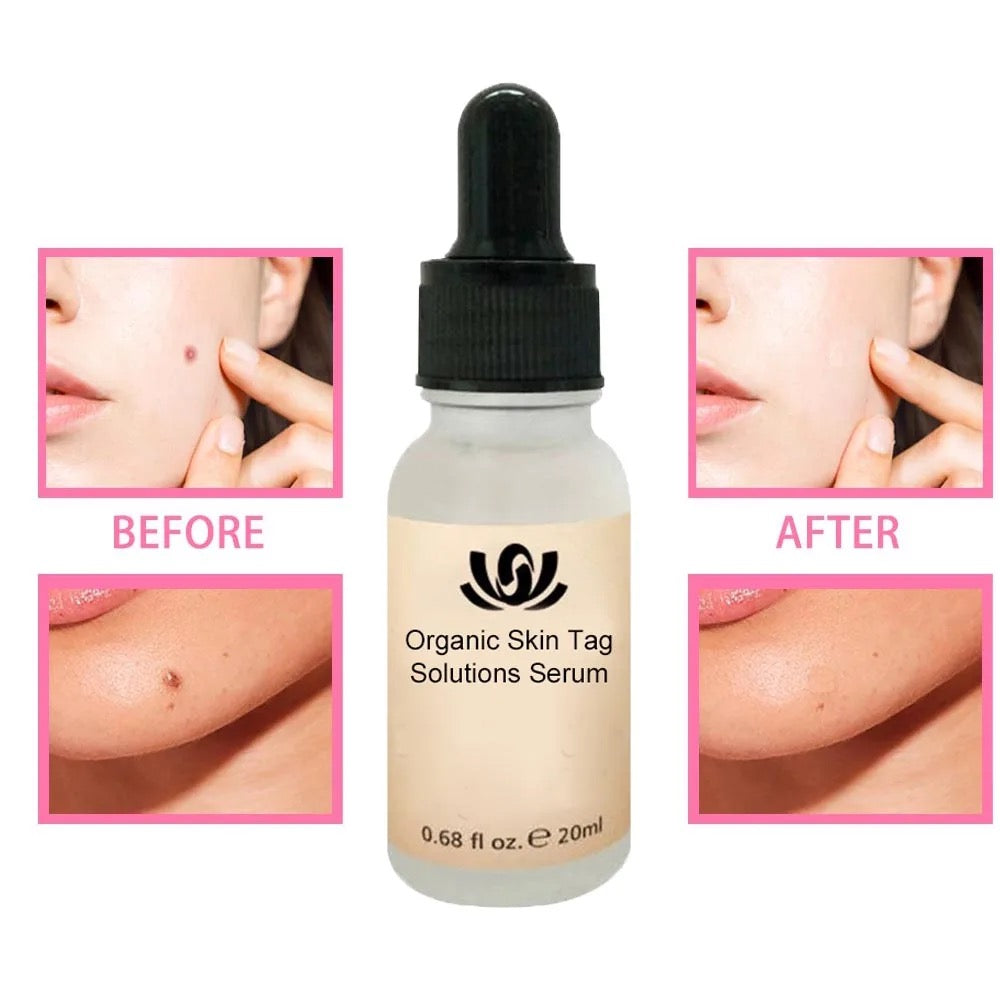 Organic skin solution serum